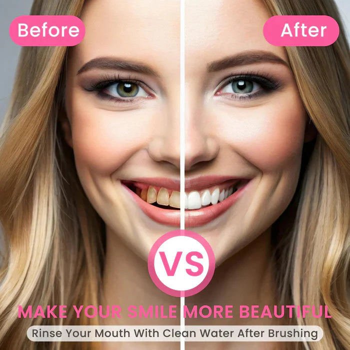 Niacinamide Toothpaste